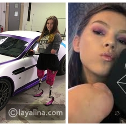 فيديو مذهل: تصنع المستحيل.. فتاة مبتورة اليدين تضع المكياج بإحترافية