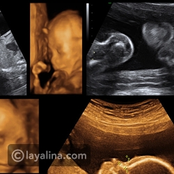 بالفيديو: هكذا يأكل ويبكي ويعطس الجنين داخل رحم أمه.. لقطات مؤثرة للغاية!