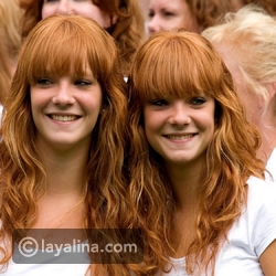 فيديو 10 حقائق مذهلة عن ذوي الشعر الأحمر